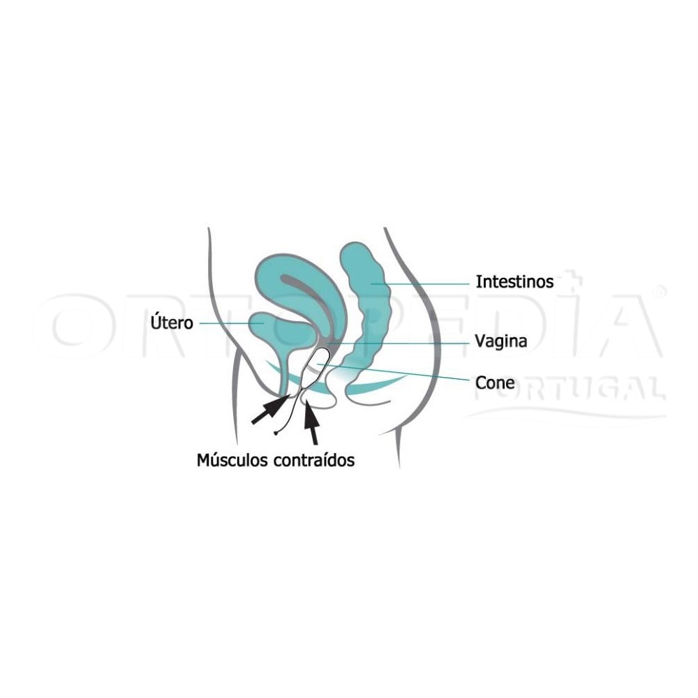 CONES VAGINAIS — imagem 3