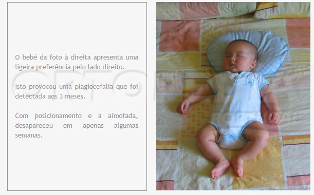 ALMOFADA MIMOS — imagem 6